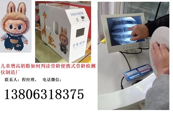 兒童大健康成長(zhǎng)奶粉如何判讀骨齡便攜式骨齡檢測(cè)儀